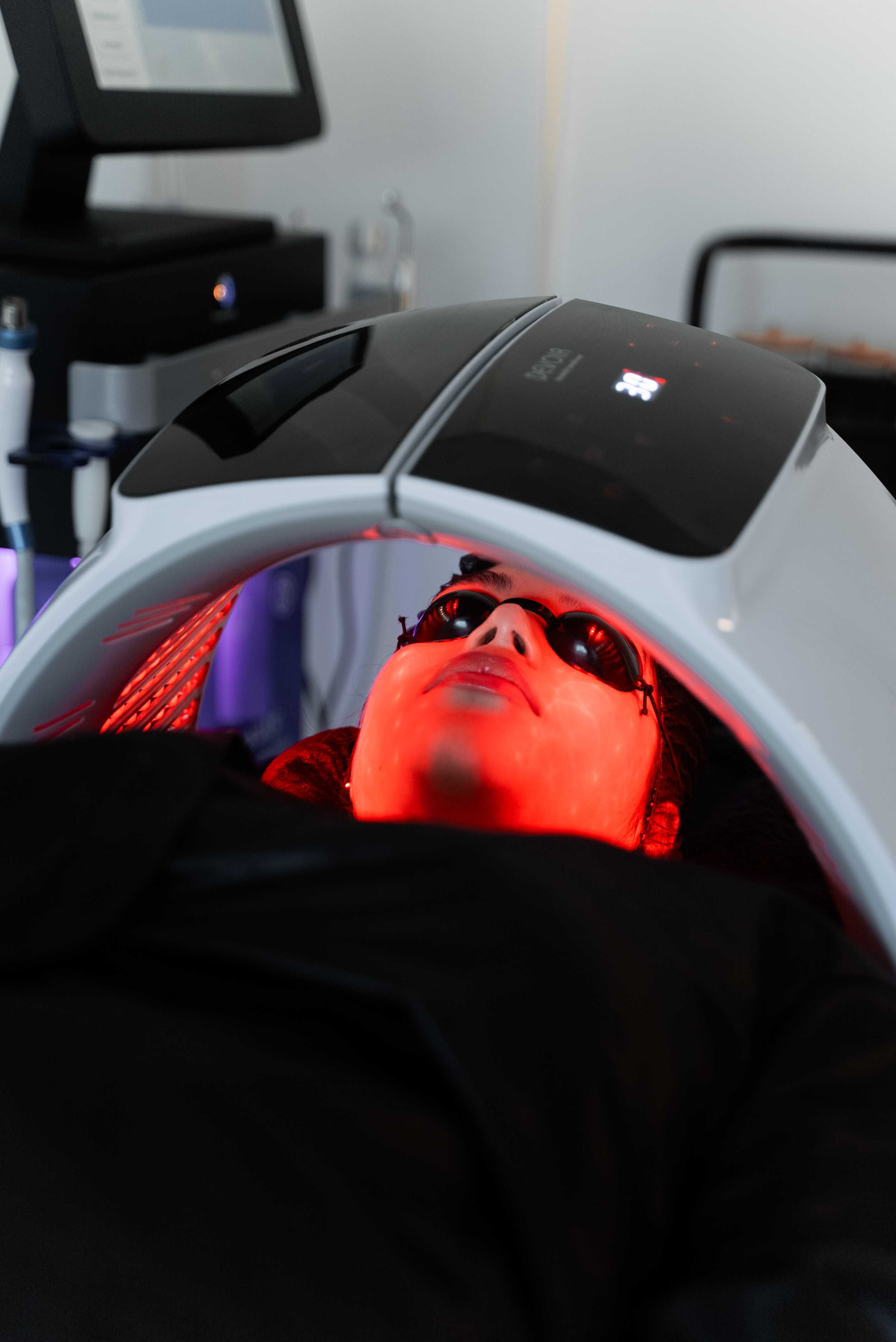 Radiofrecuencia Facial