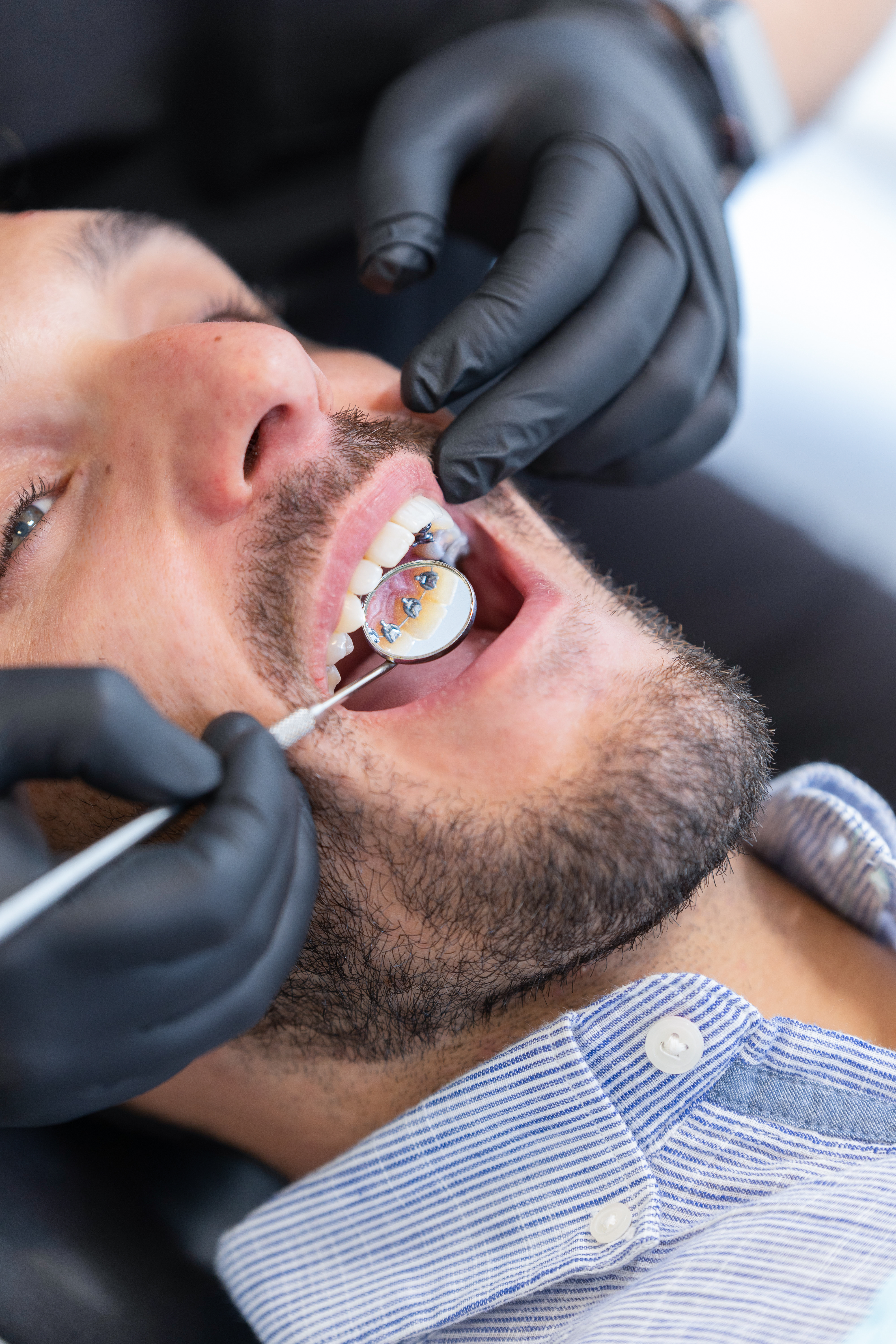 ortodoncia, clinica lingual, brackets invisibles, alineadores invisibles, brackets linguales ortodoncia, clinica lingual, brackets invisibles, alineadores invisibles, brackets linguales
