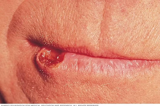cavidad oral
