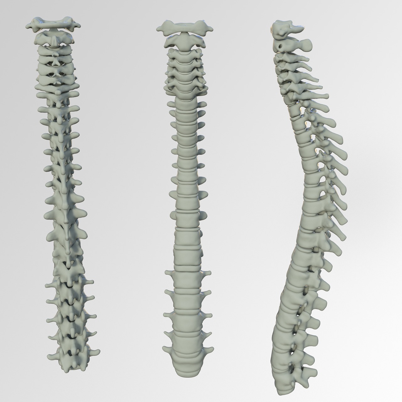What Is Spinal Decompression, And How Can It Help You Relieve Neck Pain?