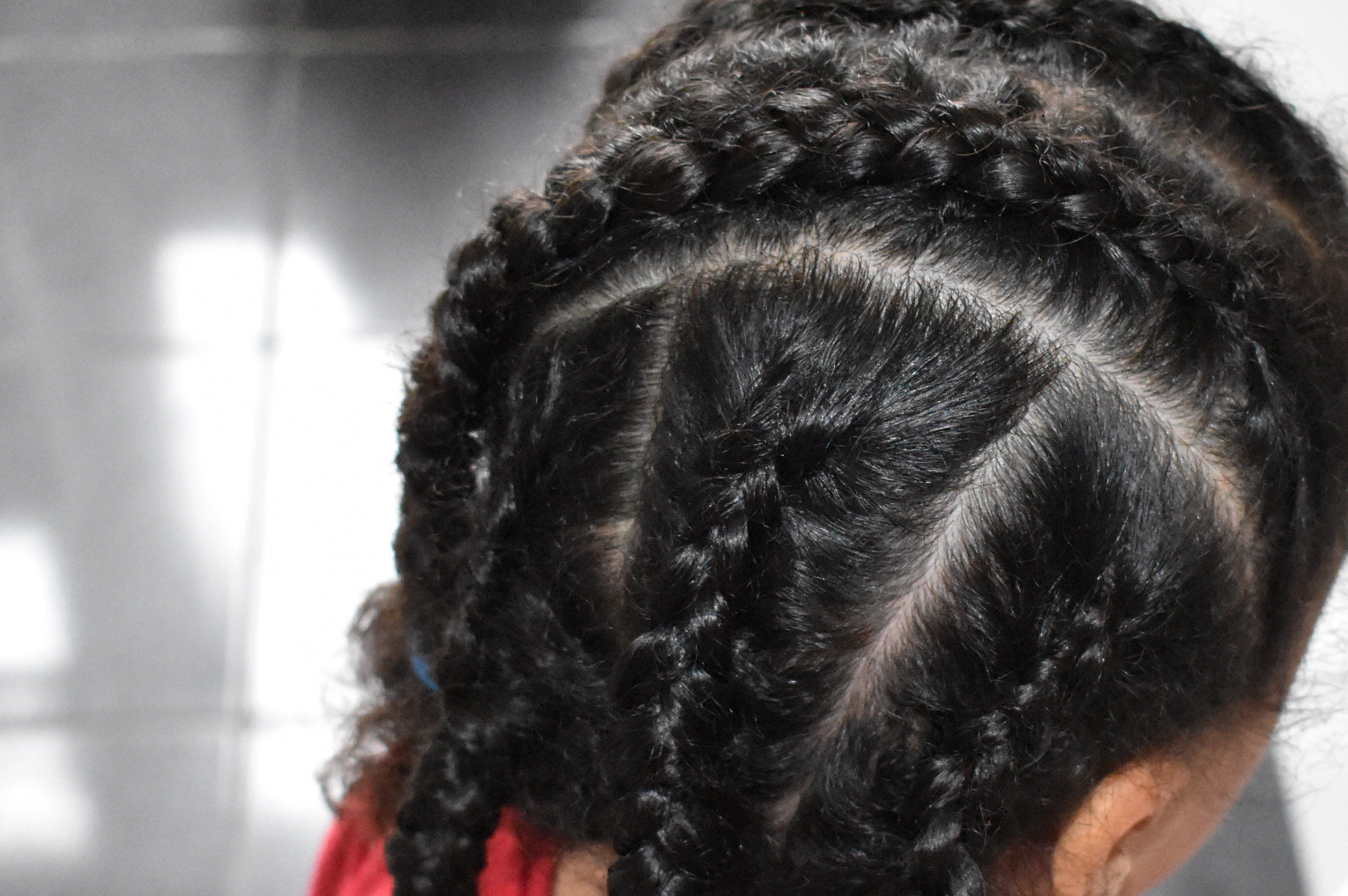 Watching Out for Scalp Issues Watching Out for Scalp Issues