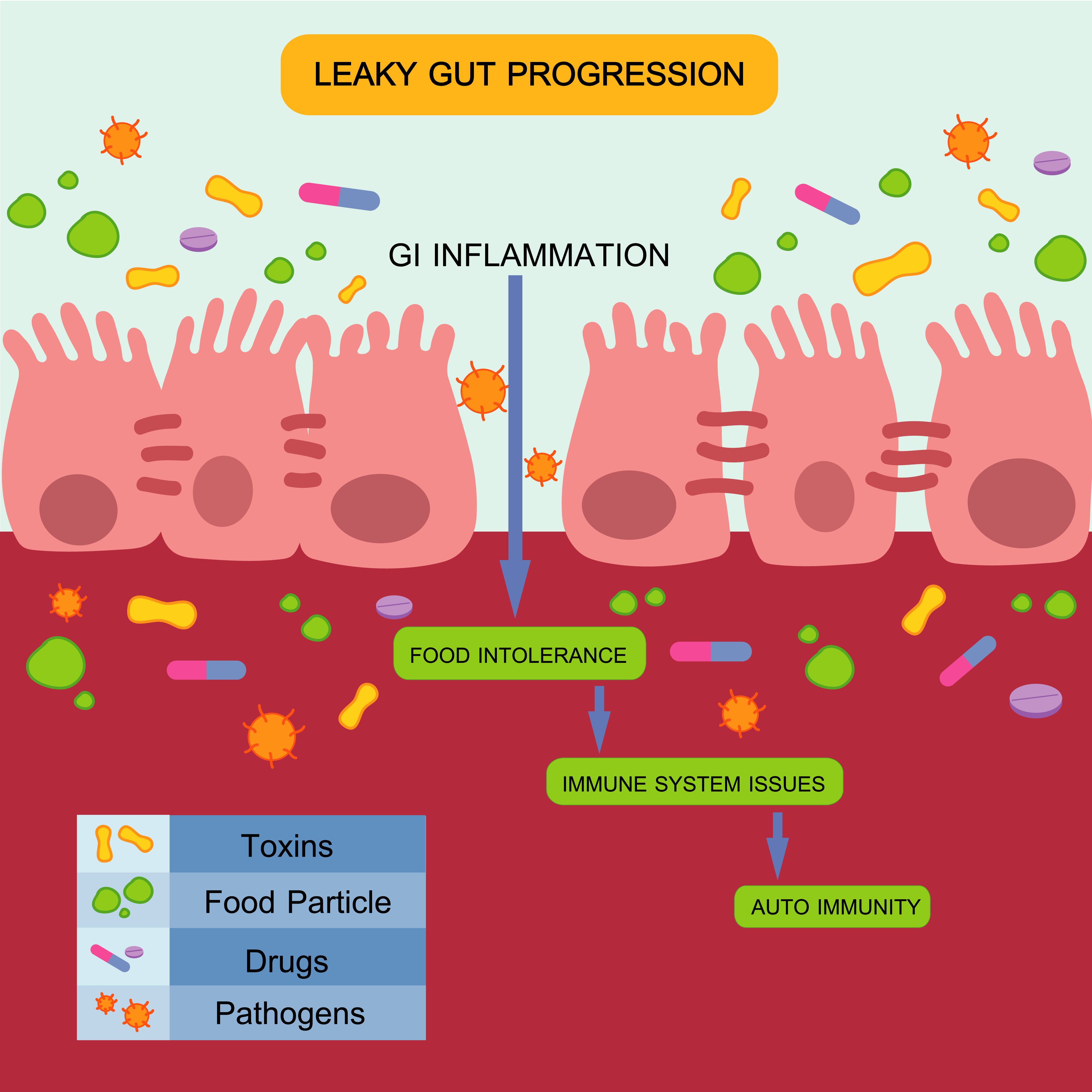 Leaky gut - the source of food sensitivities Leaky gut - the source of food sensitivities