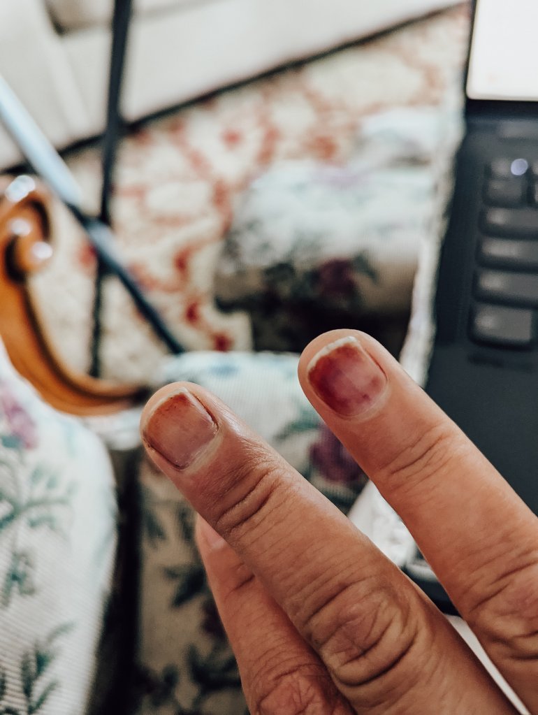 fingers fingers