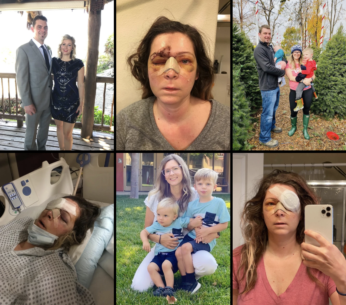 reattach retina reattach retina