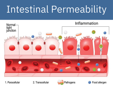 Leaky Gut Leaky Gut
