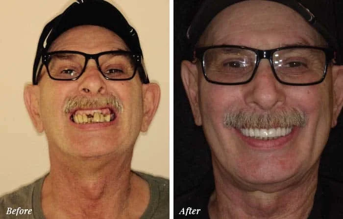 Patient Before After Image