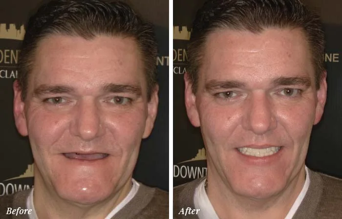 Patient Before After Image