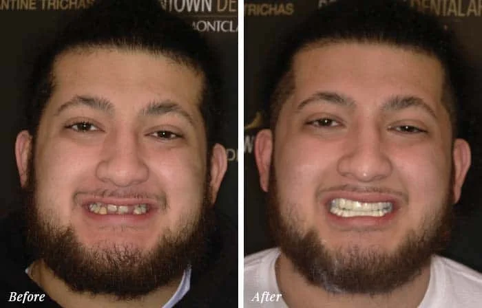 Patient Before After Image