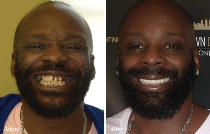 Patient Before After Image