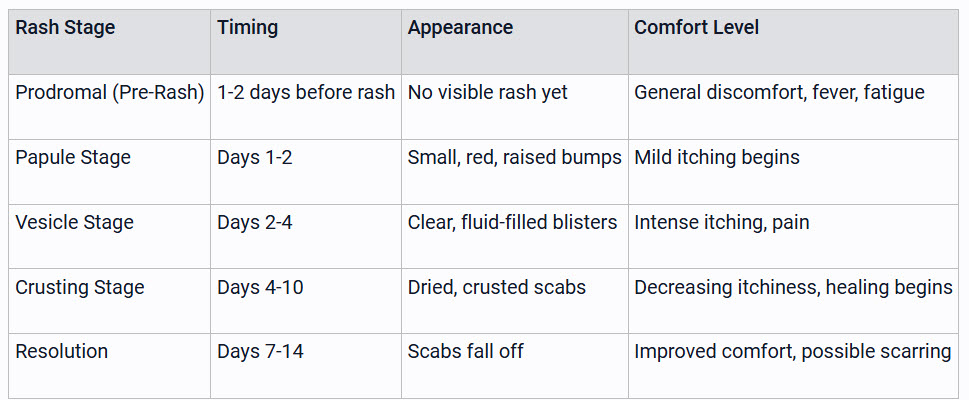 Chickenpox Rash Timeline