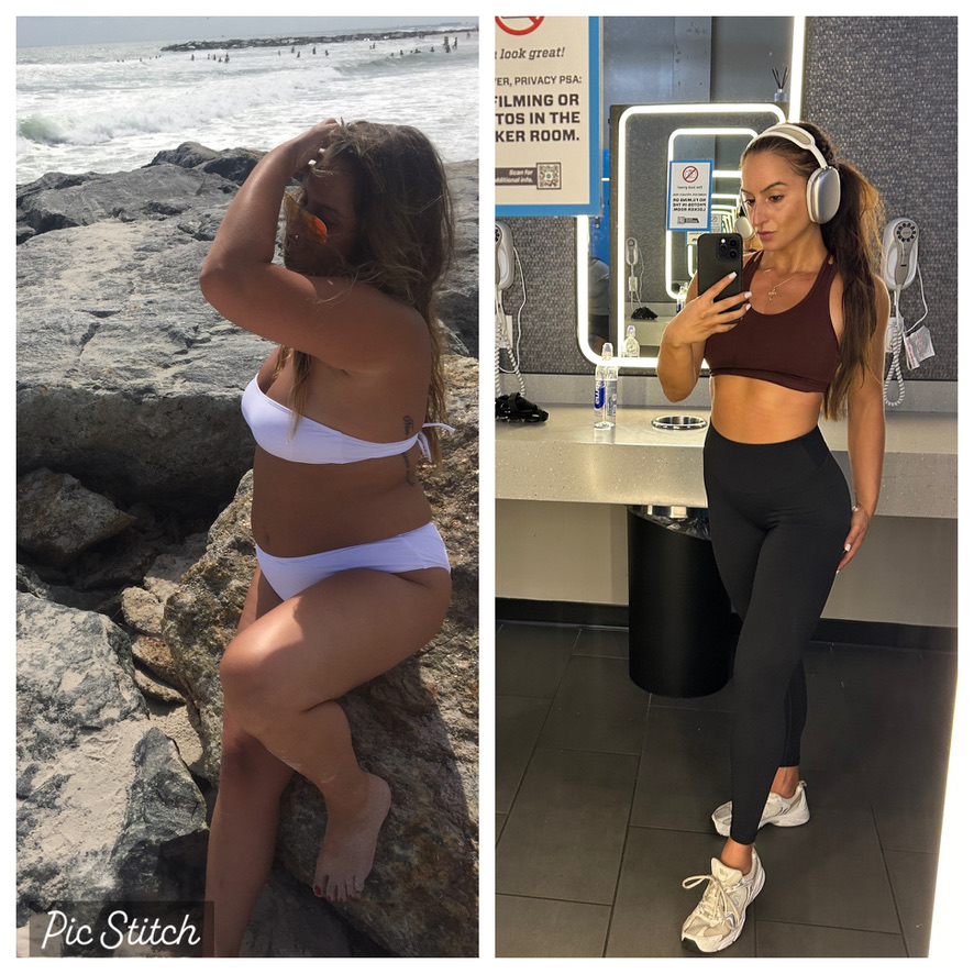 before&after
