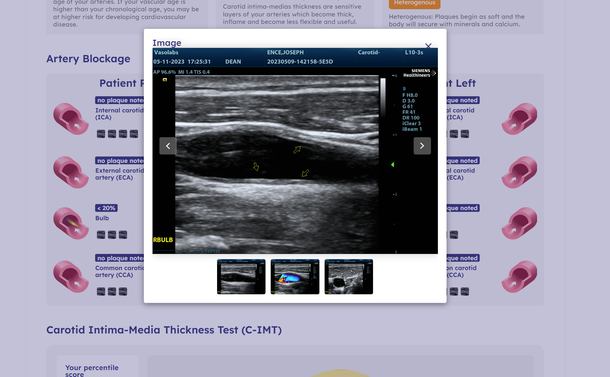 vasolabs report with ultrasound image showing