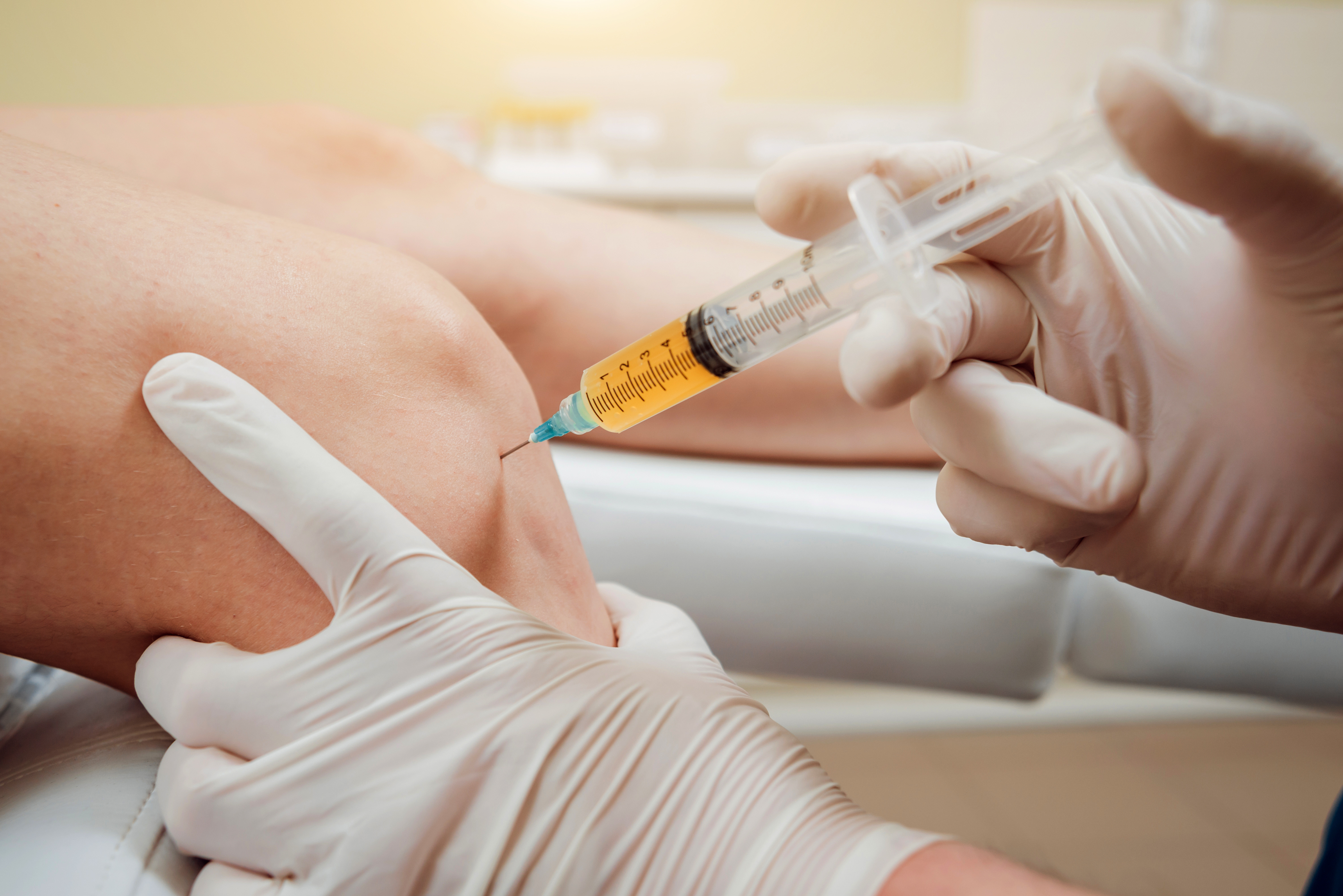 Is a $100 Platelet- Rich Plasma Injection a REAL Thing?