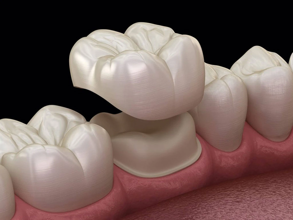 Restorative Dentistry