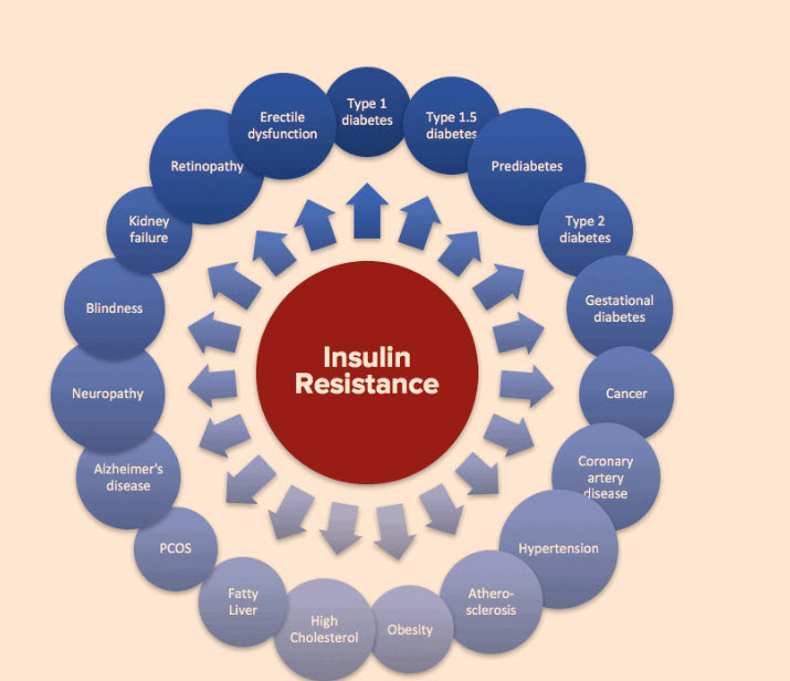 Insulin Resistance Causes, Treatment and the Best Measurement Tools and Calculations