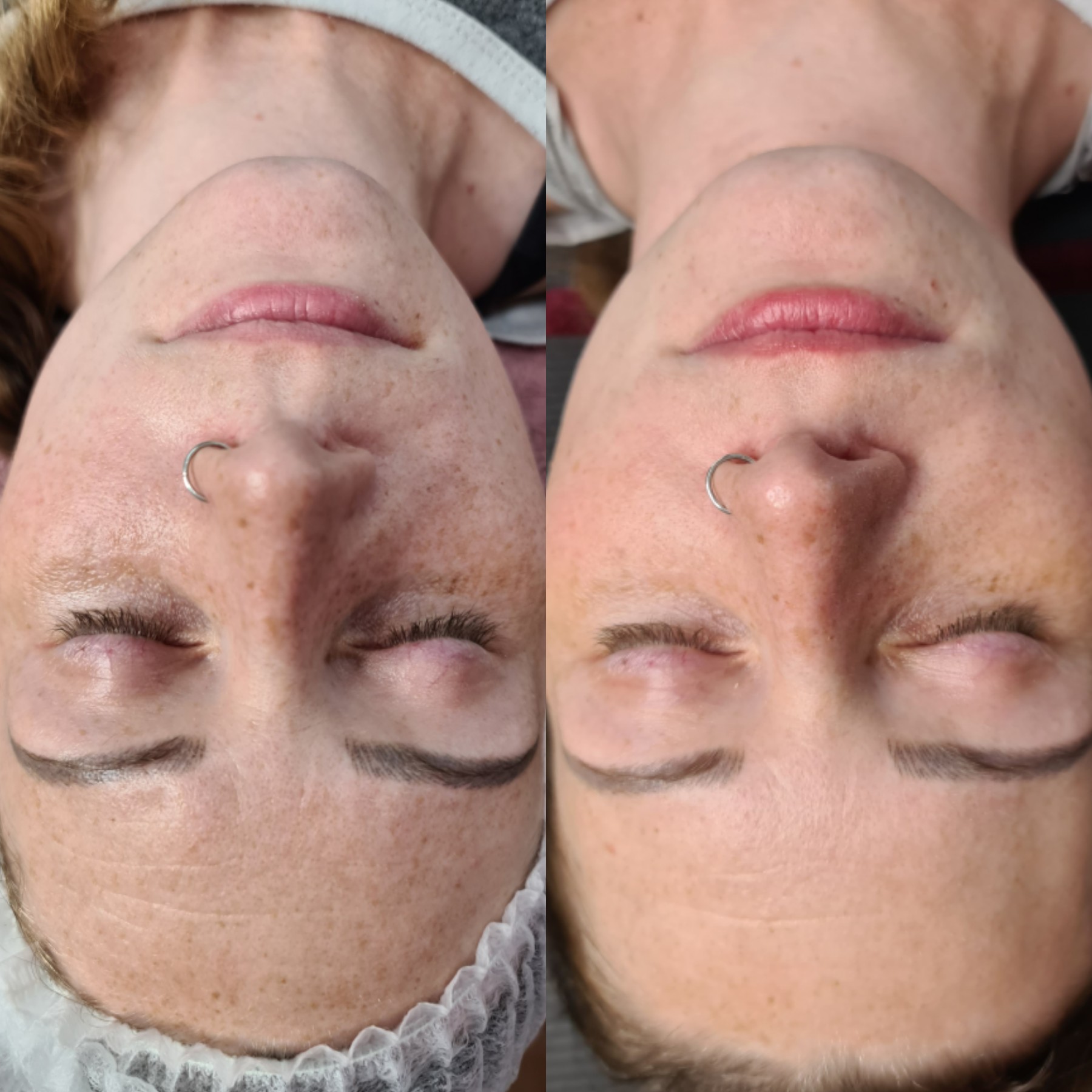 2 weeks difference using o cosmedics pure age defiance, immortal cream and gentle antioxidant cleanser