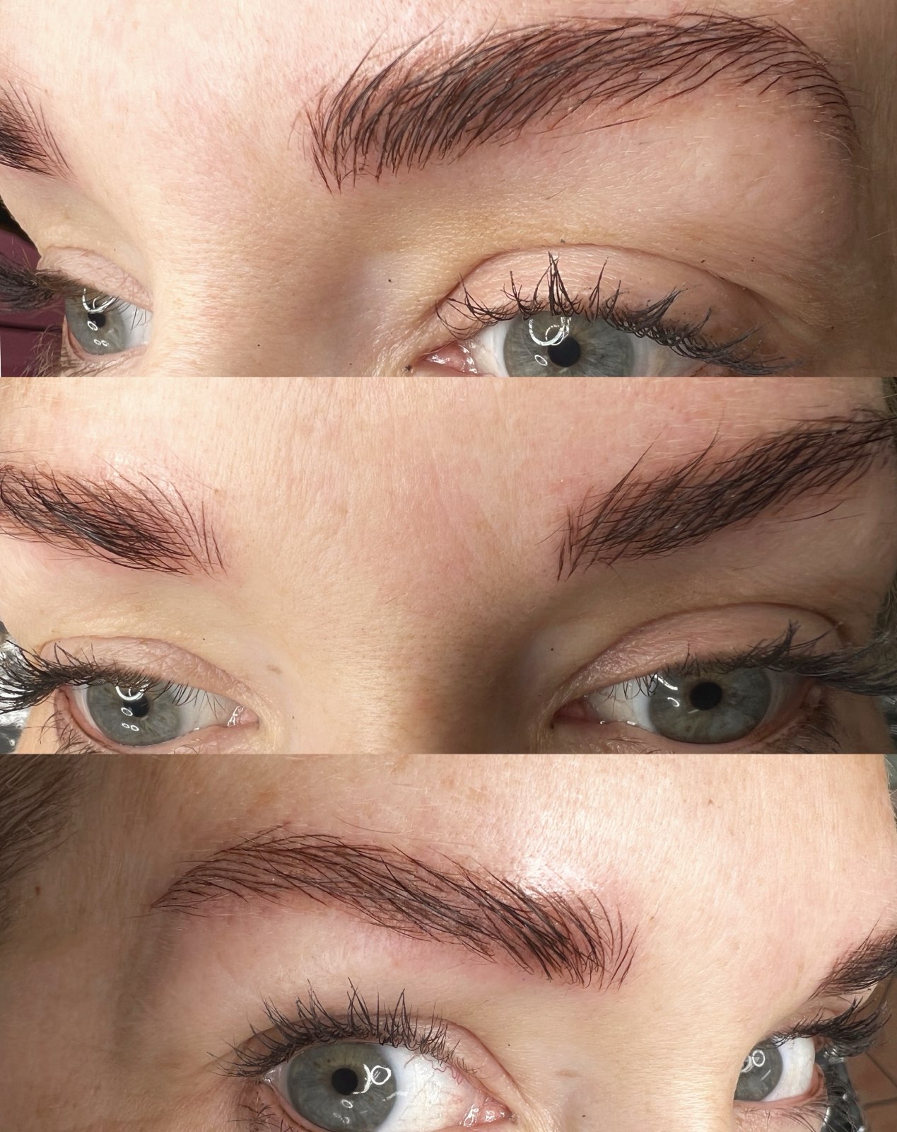 A detailed view of a Combo Brow procedure performed at Hobart's Feather Touch Aesthetics. This bespoke eyebrow treatment blends microblading and shading to deliver brows that are naturally full yet finely defined. The image showcases the expertise and precision of our seasoned brow artists, resulting in balanced and eye-catching brows that amplify the client's inherent beauty."