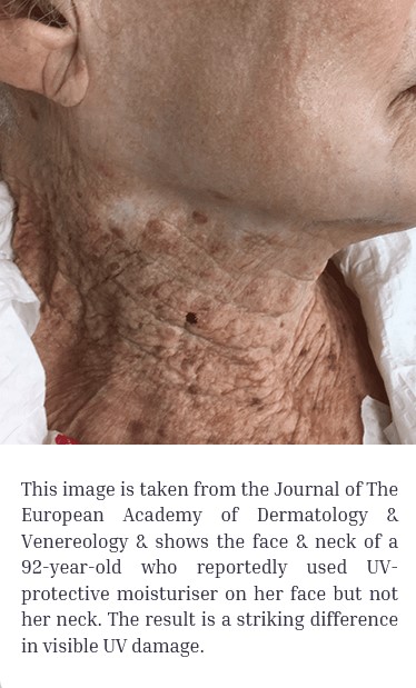 image showing why spf is important - pictured skin protected by spf and the same persons neck where it wasn't protected