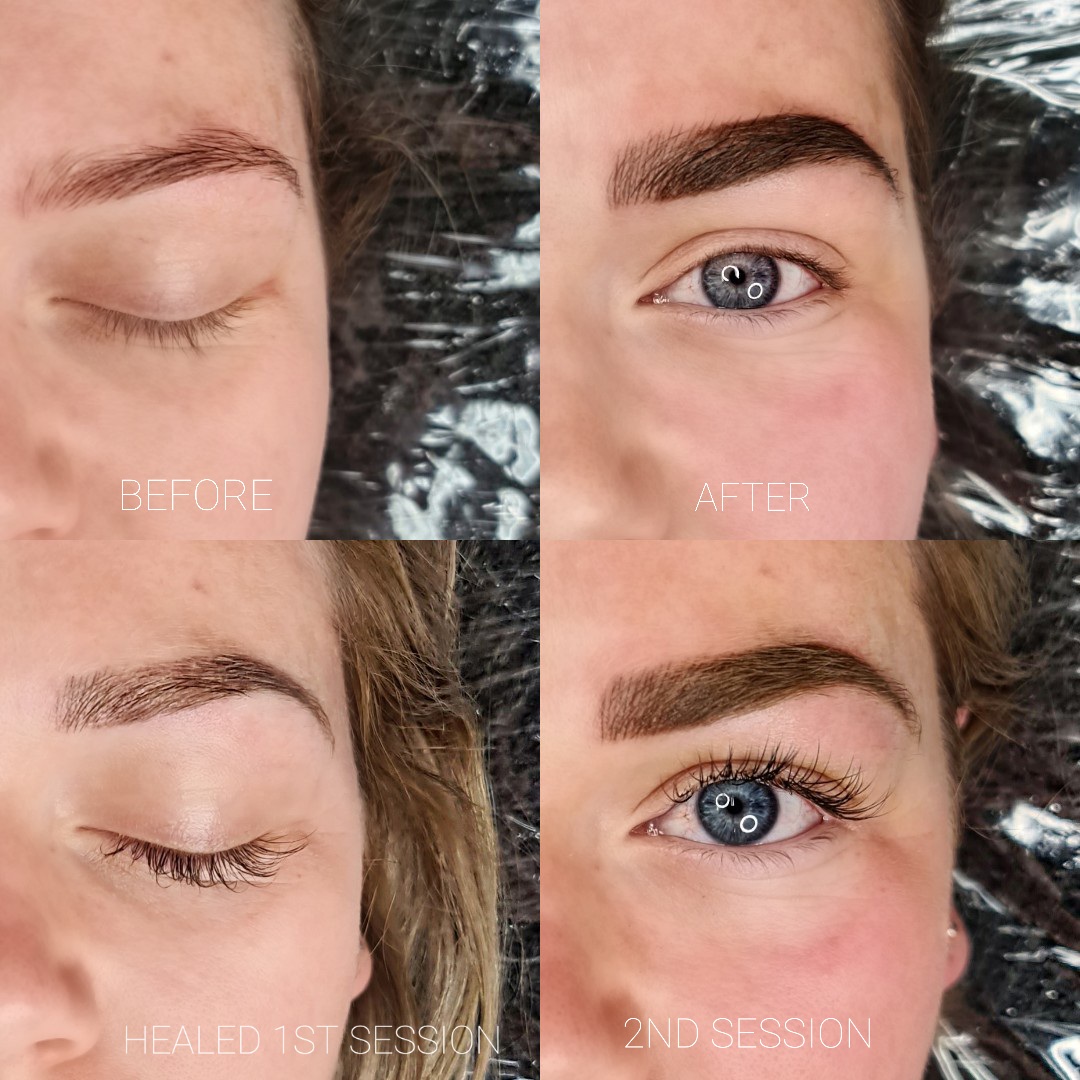 Before and after image of a client who opted for combo brows at our cosmetic tattoo clinic in Hobart, illustrating the transformation and enhancement of her natural brows.