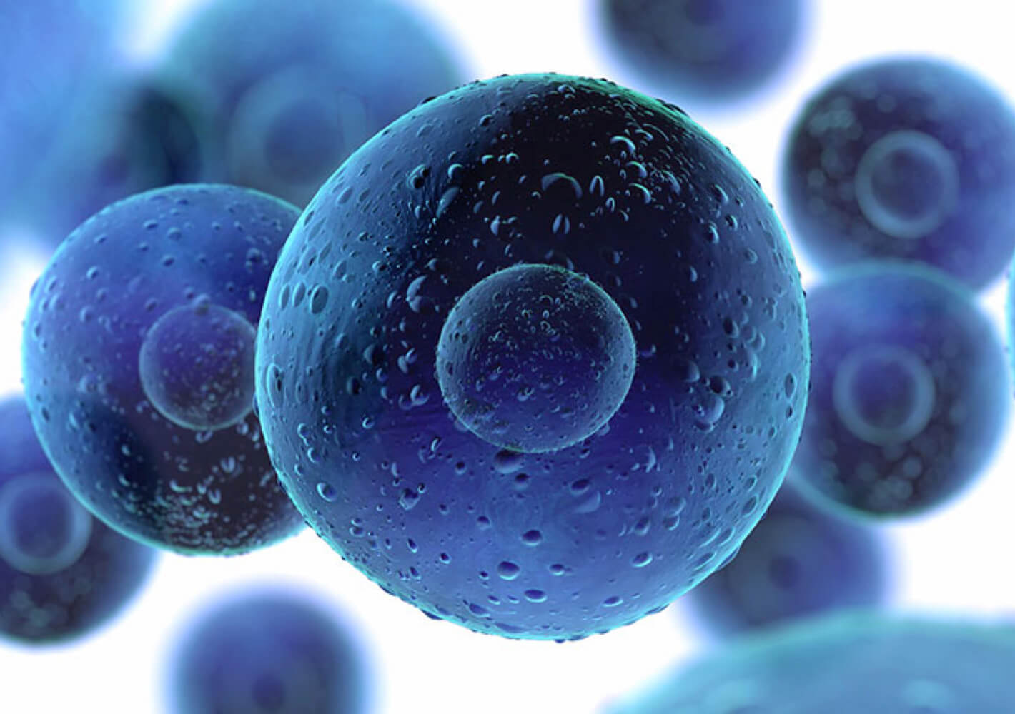 MSCs Therapy