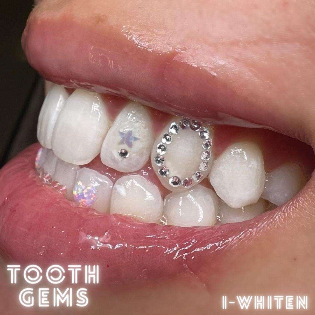 Star tooth gem on girl