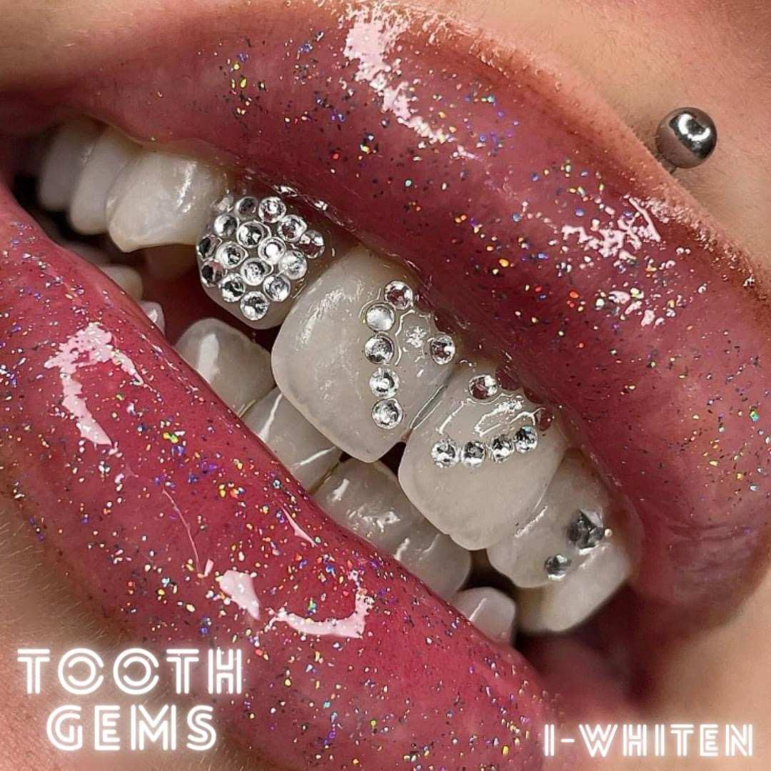 Lots of diamond tooth gems on teeth