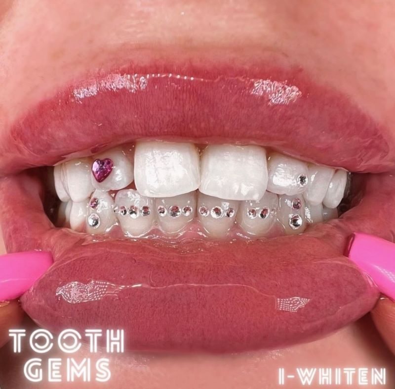 pink heart tooth gem on teeth