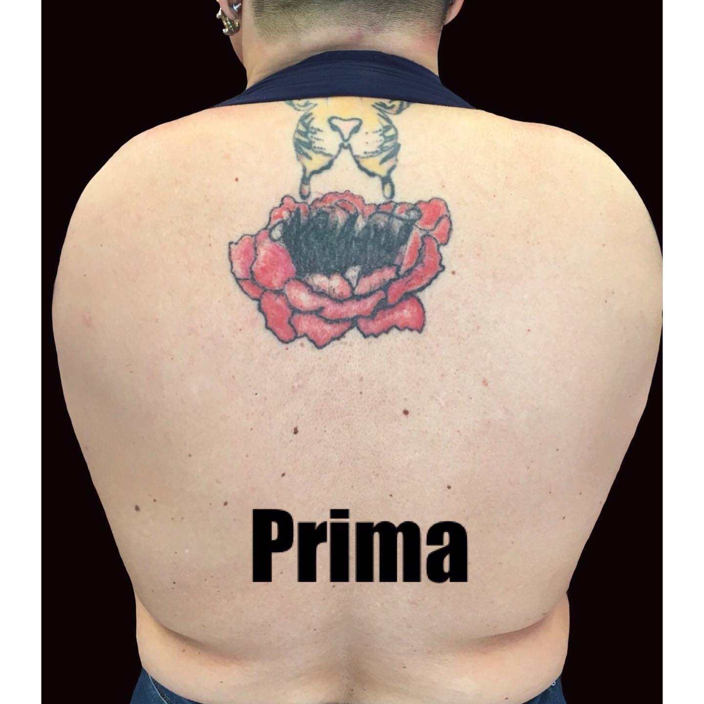 Before - Bianco e Nero