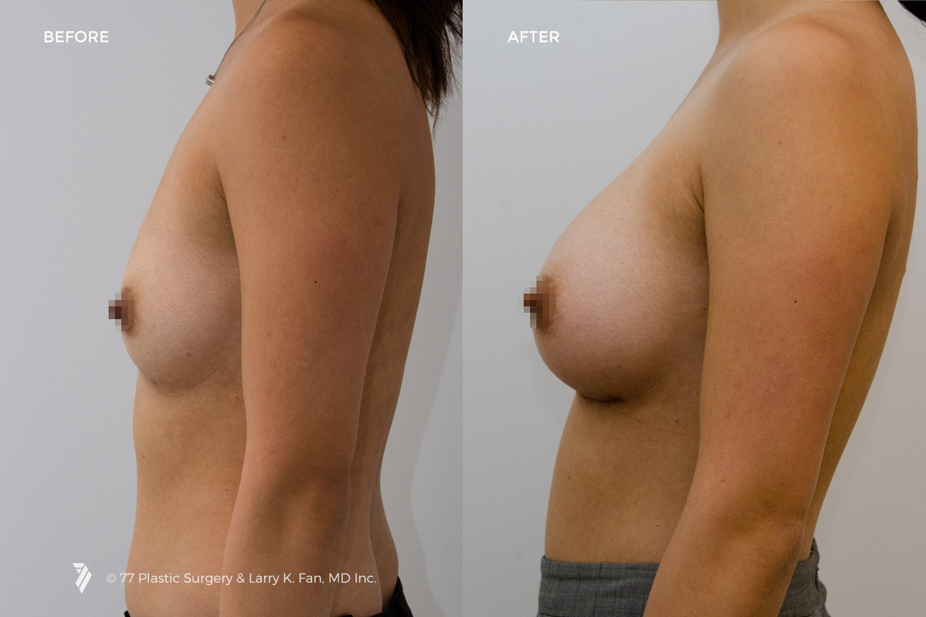 Case 22002 - Before/After 3