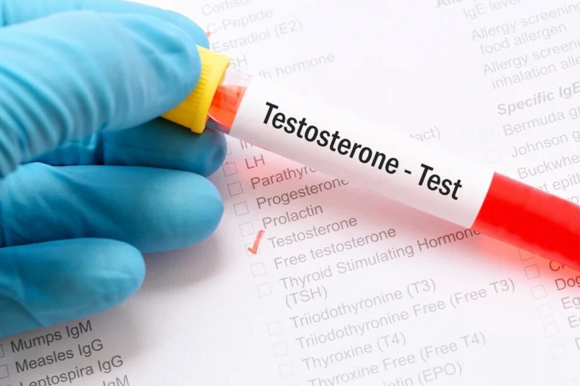Low testosterone treatment at Urgent Care Plus