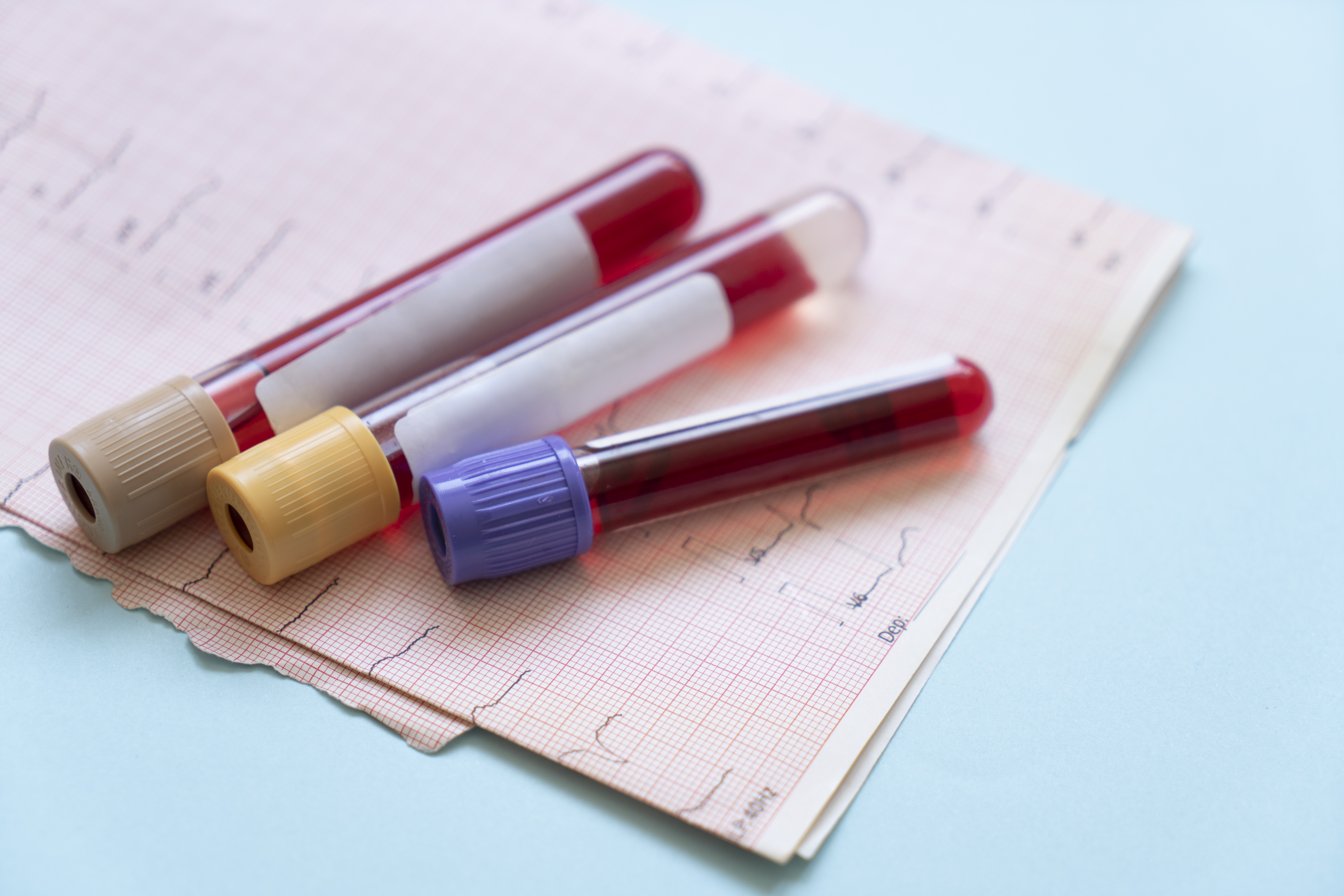 Blood testing