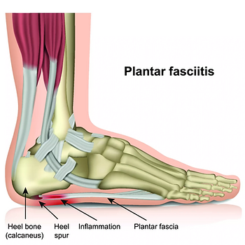 What Is The Plantar Fascia? What Is The Plantar Fascia?