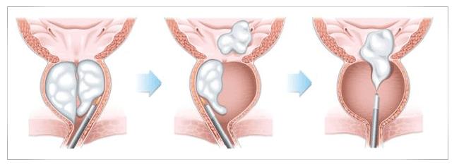 image of holep image of holep