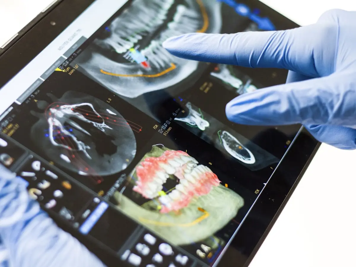 Modern Dental Equipment