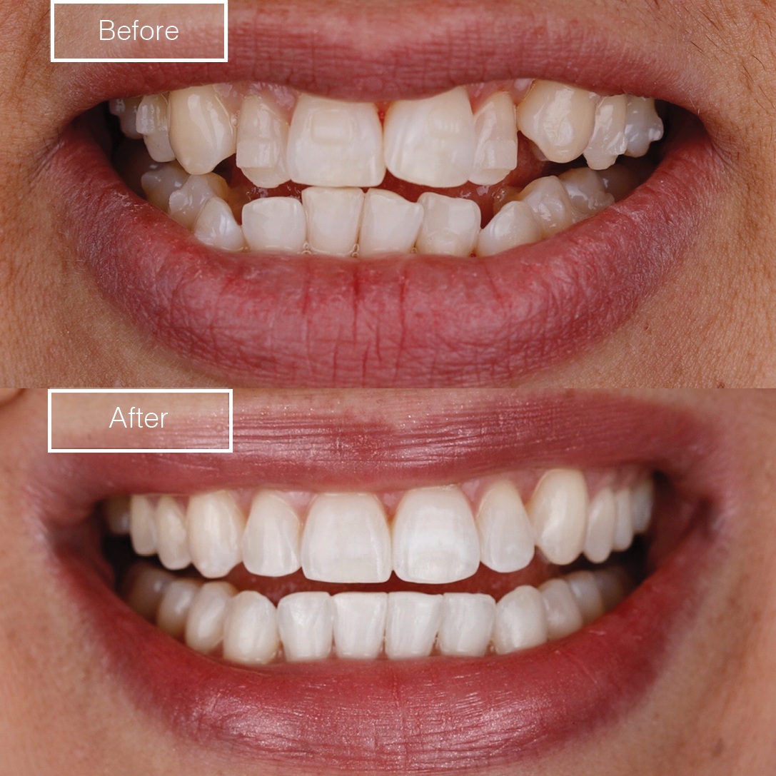 Smile 3
