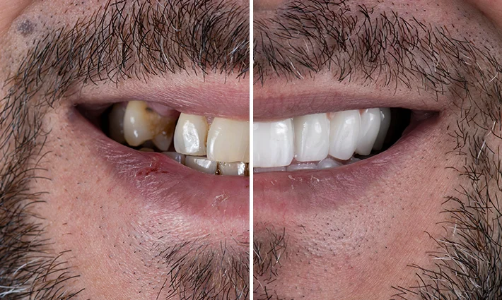 Patient Before After Image