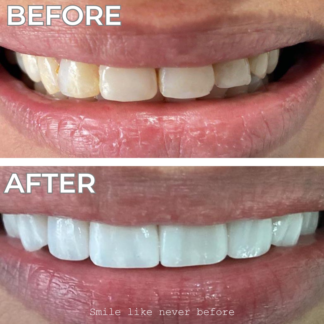 Smile 2