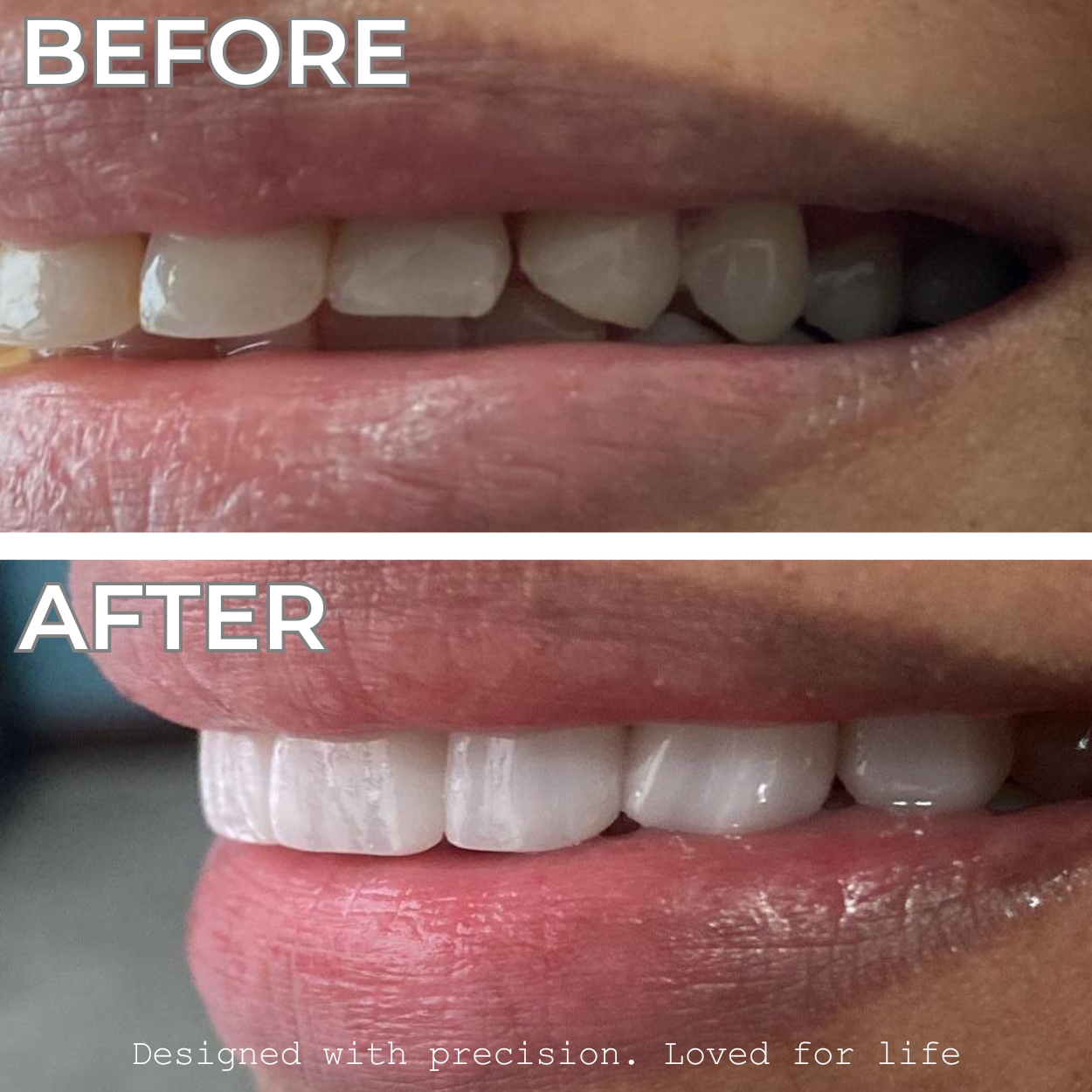 Smile 9