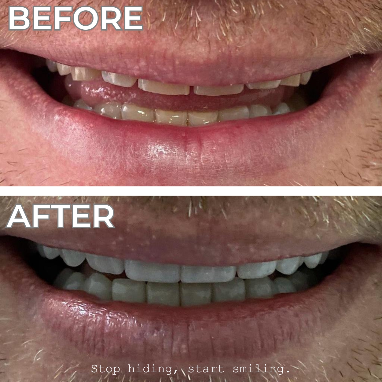 Smile 3