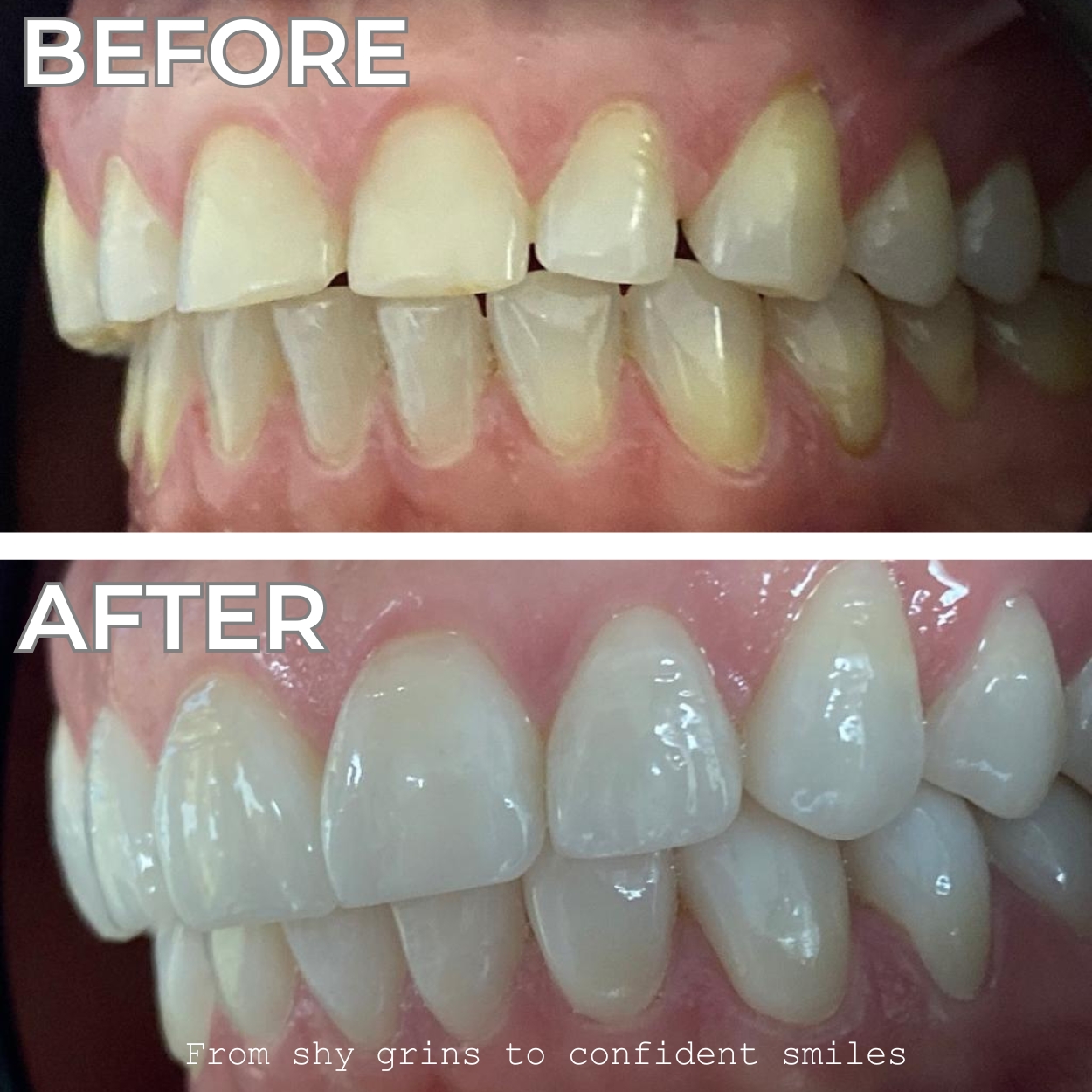 Smile 10