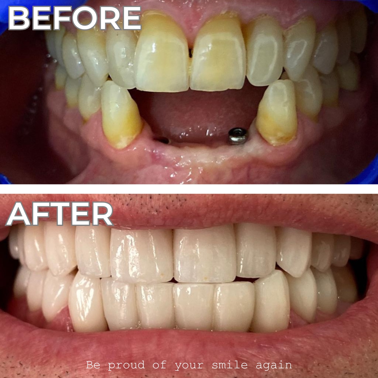 Smile 5