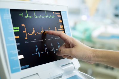ekg ekg