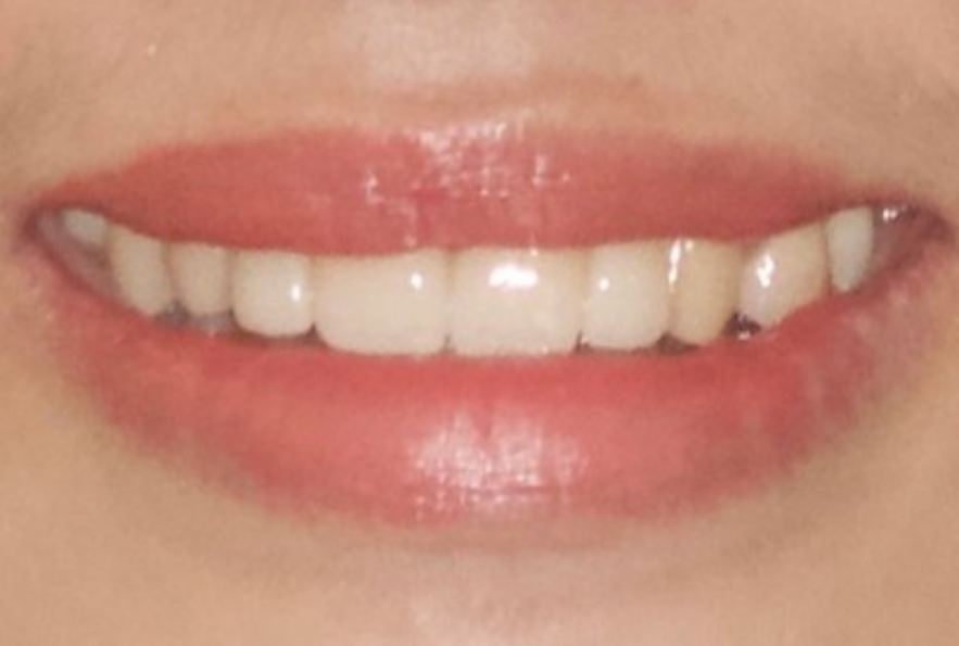 Before Image