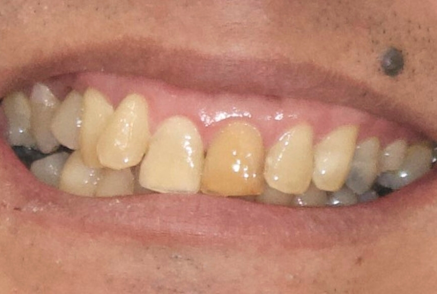 After Image