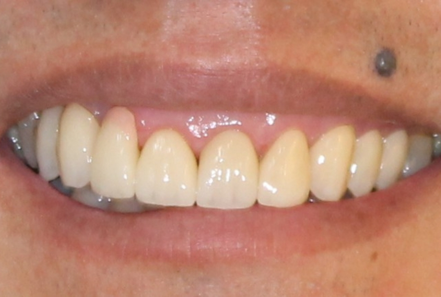 Before Image