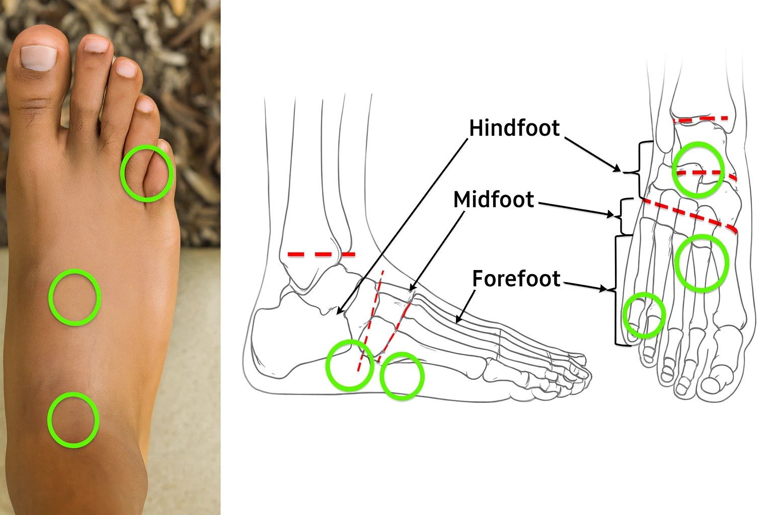 The Circulation Crisis Destroying Nigerian Feet