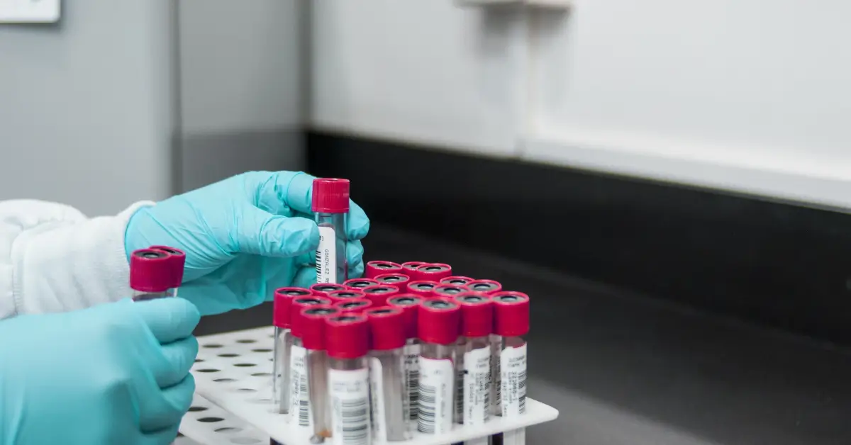 Laboratory technician handling blood samples in test tubes for thyroid function tests used to diagnose low thyroid and hypothyroidism. Laboratory technician handling blood samples in test tubes for thyroid function tests used to diagnose low thyroid and hypothyroidism.