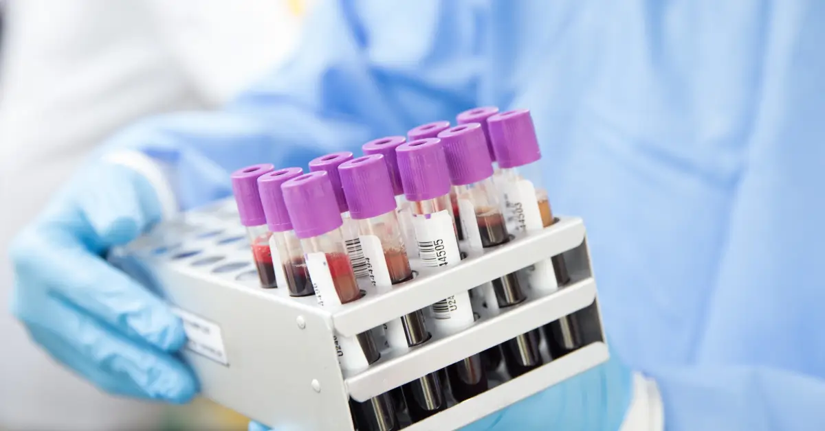 A gloved hand holding a rack of blood sample tubes with purple caps, used for laboratory testing.