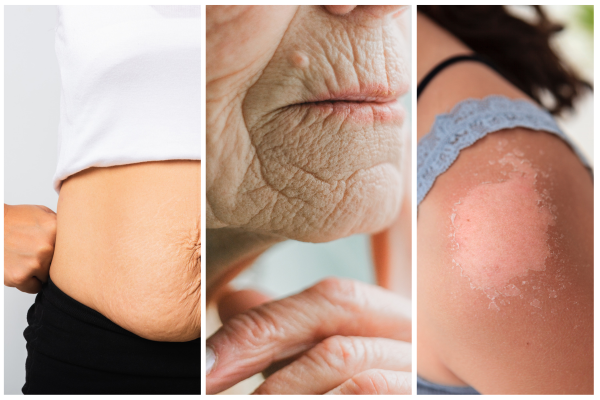aging skin aging skin