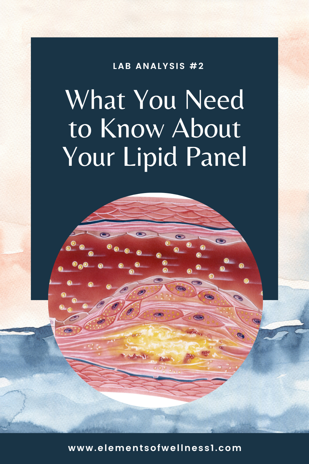 What You Need to Know About Your Lipid Panel